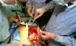 Кыргызстанда кыска убакыттын ичинде жүрөккө операция жасалды