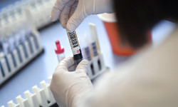 Группа специалистов расследует случаи группового инфицирования врачей COVID-19 в Ошской области