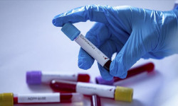 В Кыргызстане выявлены 23 новых случаев COVID-19. Всего 489