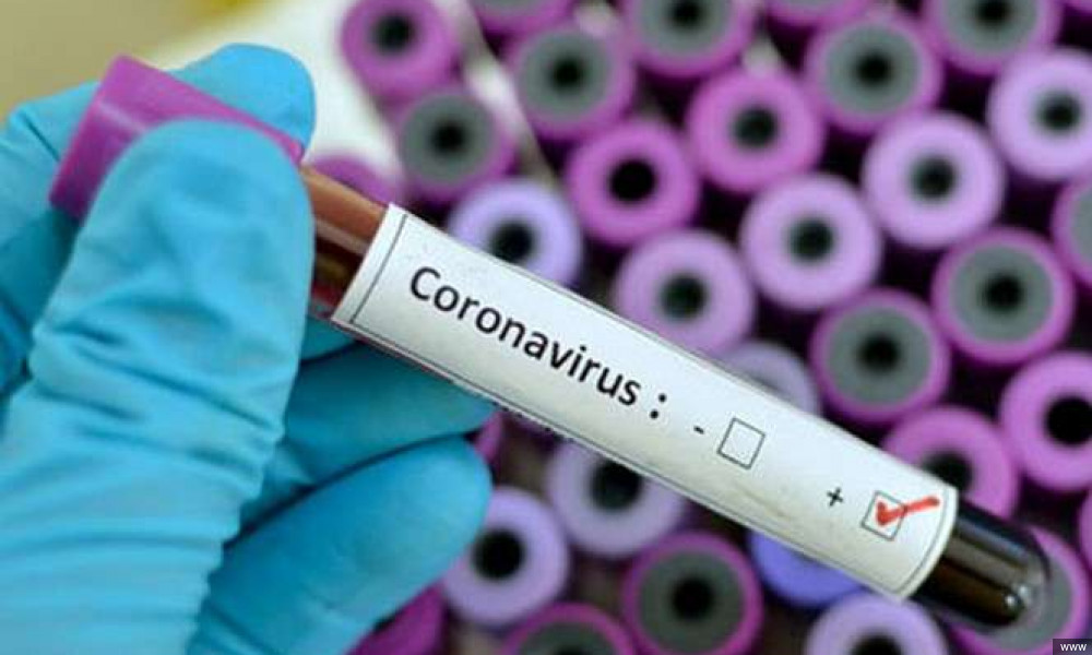 В Кыргызстане зарегистрировано 13 новых случаев заражения COVID-19