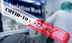 Медицинских работников за сутки с подтвержденным COVID-19 зарегистрировано 1 случай в Нарынской области