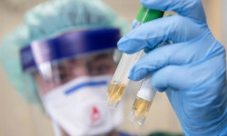 В Кыргызстане за сутки зарегистрировано 6 новых случаев заражения COVID-19. Всего - 1 117