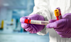 В Кыргызстане за сутки зарегистрировано 38 новых случаев заражения COVID-19. Всего - 1 403