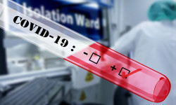В Кыргызстане за сутки зарегистрировано 52 новых случаев заражения COVID-19