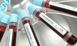 За сутки в Кыргызстане зафиксировано 69 новых случаев заражения COVID-19 - Новости Кыргызстана