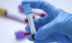 За прошедшие сутки зафиксировано два летальных исхода от COVID-19 - Новости Кыргызстана