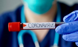 За прошедшие сутки зафиксировано 3 летальных исхода от COVID-19 - Новости Кыргызстана