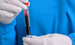 Өлкө боюнча 42 медицина кызматкери коронавирус жуктуруп алды