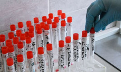 В Кыргызстане за сутки выявлены 506 новых случаев COVID-19