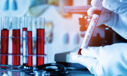 Медицинских работников за сутки с COVID-19 зарегистрировано 47 случаев - Новости Кыргызстана