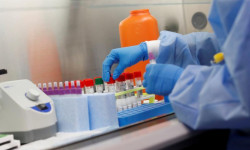 Өлкөдөгү коронавирустун жайылышынын себептери иликтенүүдө    