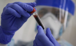 В Кыргызстане увеличилось число новых случаев COVID-19