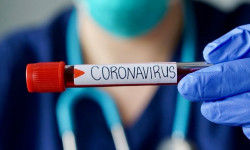 За сутки по стране выявлен 161 новый случай заражения COVID-19 