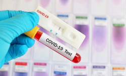COVID-19: Эпидемиологическая ситуация в Кыргызстане - 28.09.2020