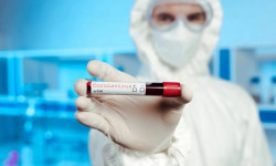 В Казахстане в минувшие сутки был зарегистрирован 71 новый случай COVID-19