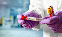 В Кыргызстане за сутки зарегистрировали 307 случаев инфицирования COVID-19