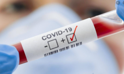 В Кыргызстане уже 554 новых случая COVID-19 на 18 октября