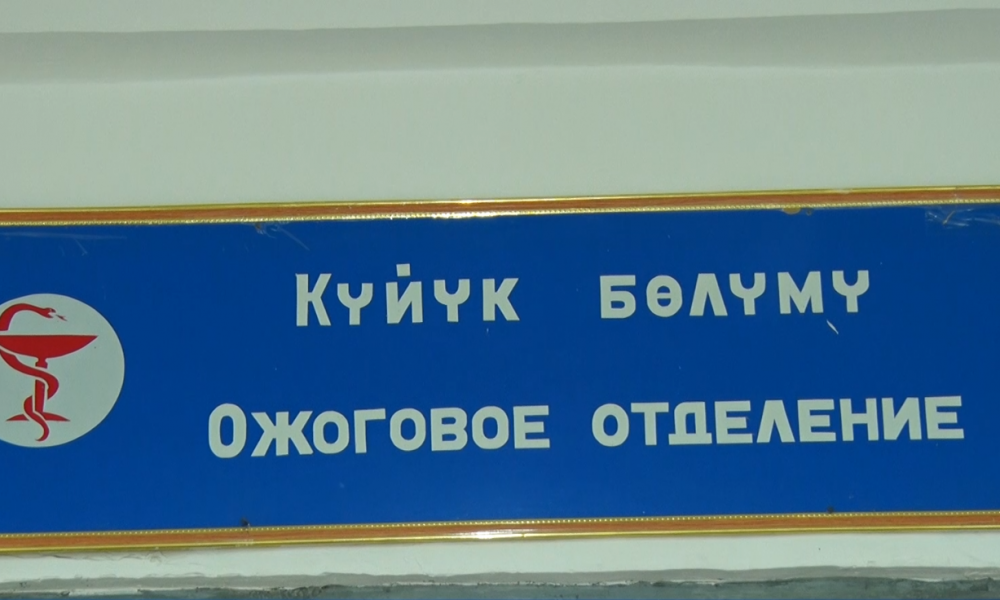Күйүп калган наристе жардамга муктаж 