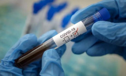 За прошедшие сутки в Кыргызстане зарегистрировано 582 новых случая COVID-19