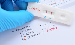 COVID-19: ооруну жугузуп алуудан сак болуңуз 