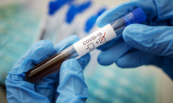За сутки выявлено 522 новыx случая внебольничной пневмонии и COVID-19