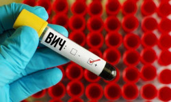 ВИЧ-инфекциясын жуктургандардын санынын өсүшү боюнча кайсы район алдыда турат?