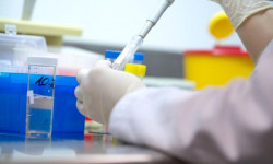 COVID-19: өткөн суткада коронавирус 378 адамдан табылып, 4 жаран каза болду