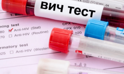 ВИЧ илдетин аныктоочу тесттерди көбөйтүү зарылдыгы айтылды 