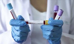 В Кыргызстане за сутки выявили еще 341 случай внебольничной пневмонии и COVID-19