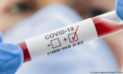 COVID-19: Учурдагы абал