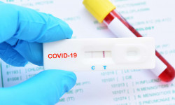 Исследования подтверждают, что хотя бы один член семьи болел COVID-19 или пневмонией