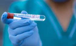 За последние сутки зафиксировано 136 новых случаев COVID-19, и 3 летальных исхода