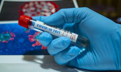 В Кыргызстане за последние сутки выявили еще 128 случаев заражения COVID-19, 3 умерли