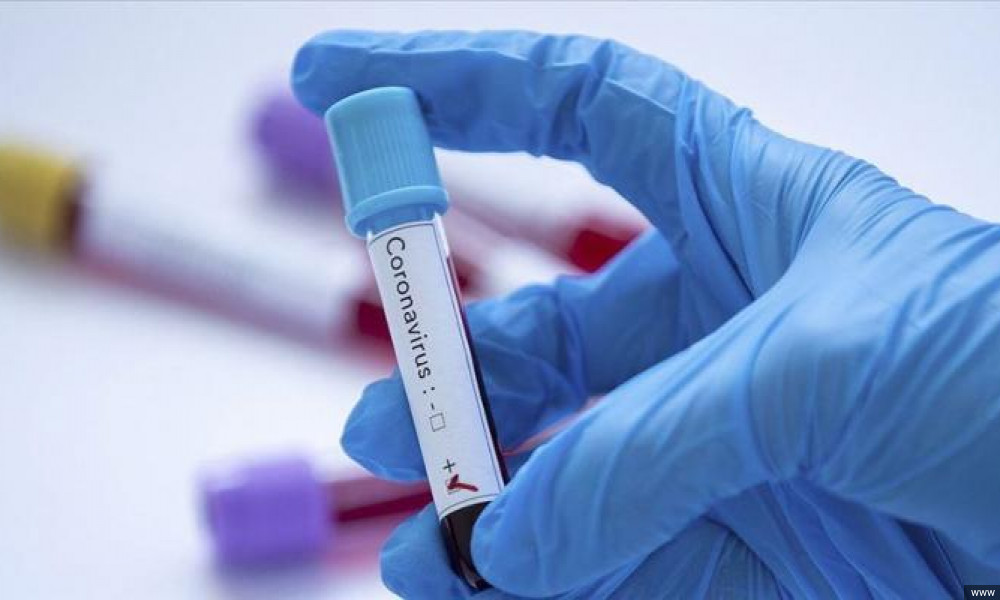 COVID-19: өткөн суткада 74 кишиден инфекция аныкталып, 1 бейтап көз жумду  