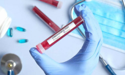 В Кыргызстане за сутки выявили еще 58 случаев заражения COVID-19, 2 умерли