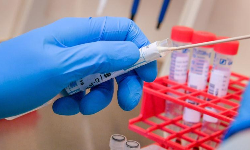 Лаборатории, где можно сдать ПЦР-тест выезжающим за пределы КР
