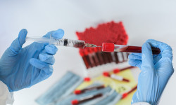 Өлкөдө бир суткада коронавирус 33 адамдан табылып, 2 бейтап каза болду