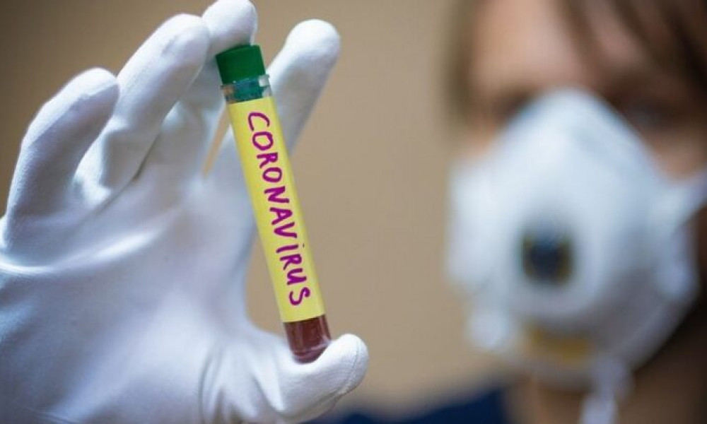 В Кыргызстане выявили 52 новых случая COVID-19 и пневмонии. Всего — 86 692
