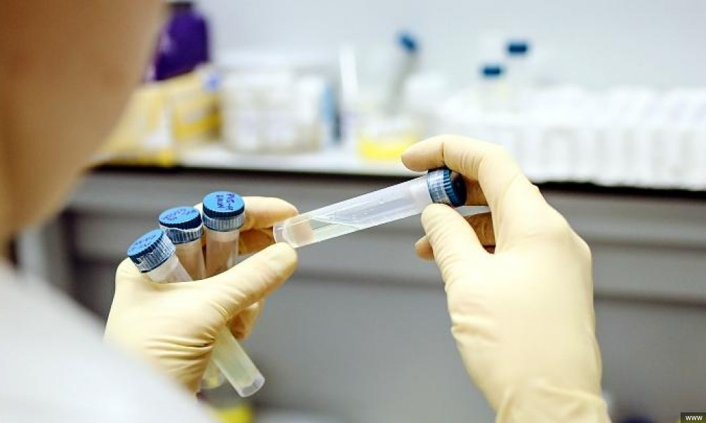 Ысык-Көлдө коронавируска чалдыккан кырк сегиз жаран даарыланууда. Экөө оор абалда