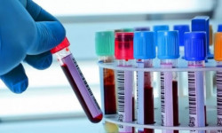 За сутки в Кыргызстане выявили еще 305 новых случаев заражения COVID-19, 6 умерли