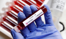COVID-19: Кыргызстан "AstraZeneca" вакцинасын алат