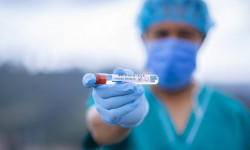За сутки в Кыргызстане выявили еще 212 новых случаев заражения COVID-19, 6 умерли