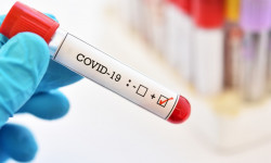 COVID-19: Кыргызстанда 7 бейтап каза болду