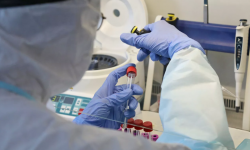 За сутки выявили 329 случаев внебольничной пневмонии и COVID-19