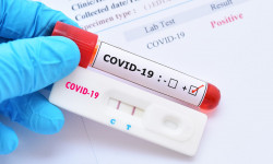 За сутки в Кыргызстане выявили еще 200 случаев заражения COVID-19, 6 умерли