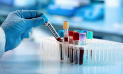 В Кыргызстане за сутки зарегистрировали 1 330 случаев инфицирования ковидом