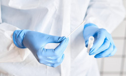 За сутки в Кыргызстане умерли десять пациентов с COVID-19, вирус выявили у 797 человек