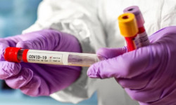 В Кыргызстане за сутки выявлено 66 новых случаев заражения COVID-19