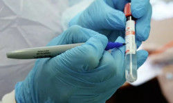 Статистические данные по COVID-19 в Кыргызстане на 17 декабря