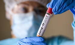COVID-19: В Кыргызстане за сутки выявили 870 новых случаев